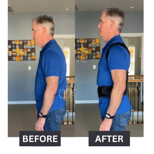 Vibrant Posture Corrector™