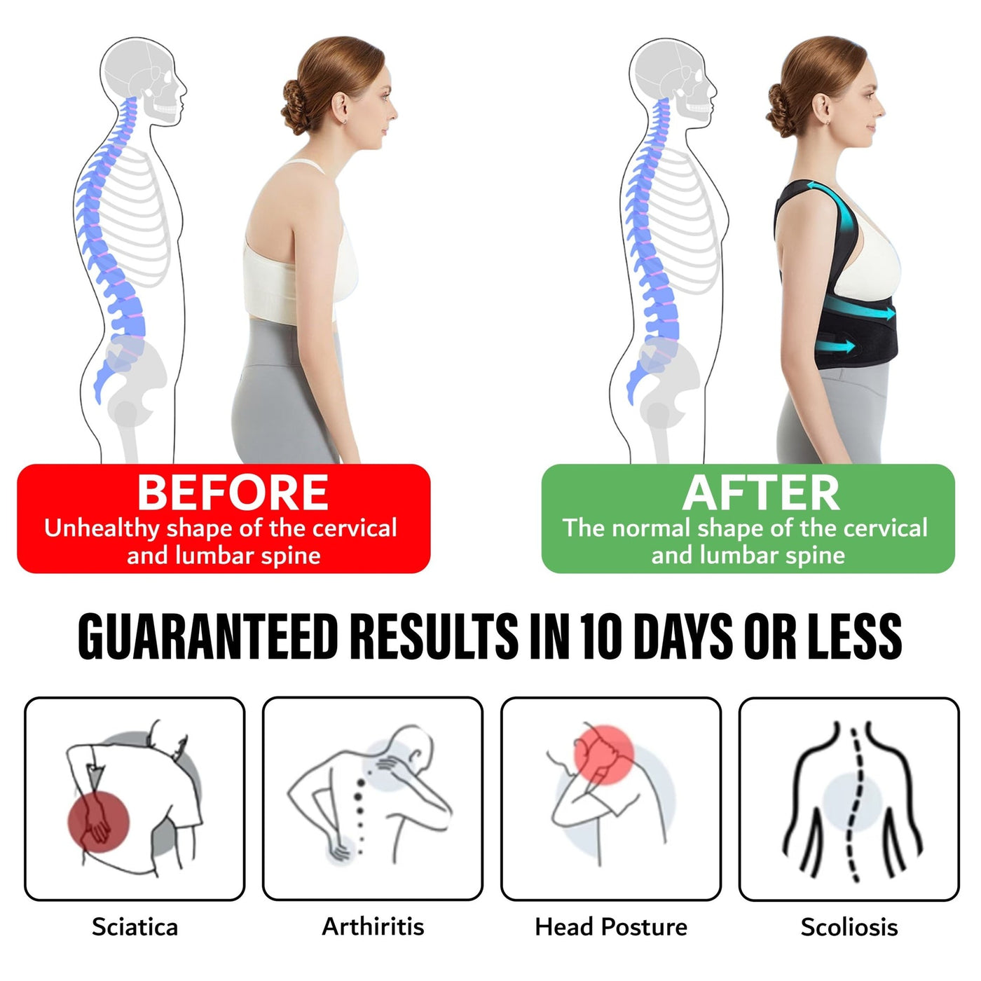 Vibrant Posture Corrector™